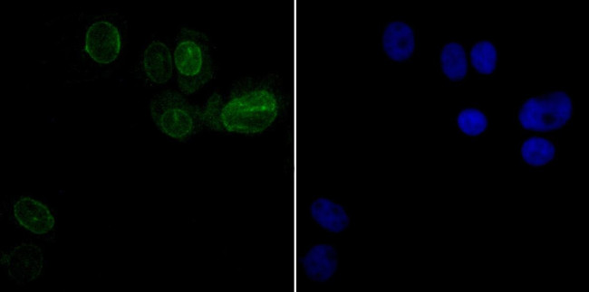 UNC84B Antibody in Immunocytochemistry (ICC/IF)