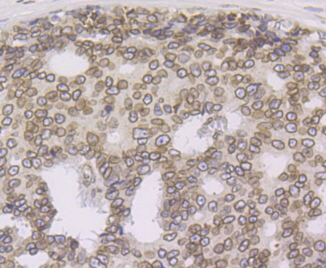 UNC84B Antibody in Immunohistochemistry (Paraffin) (IHC (P))