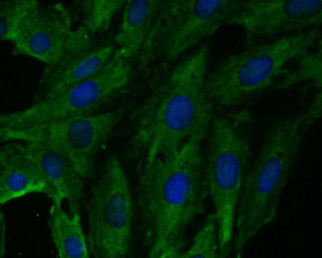 FBXO32 Antibody in Immunocytochemistry (ICC/IF)