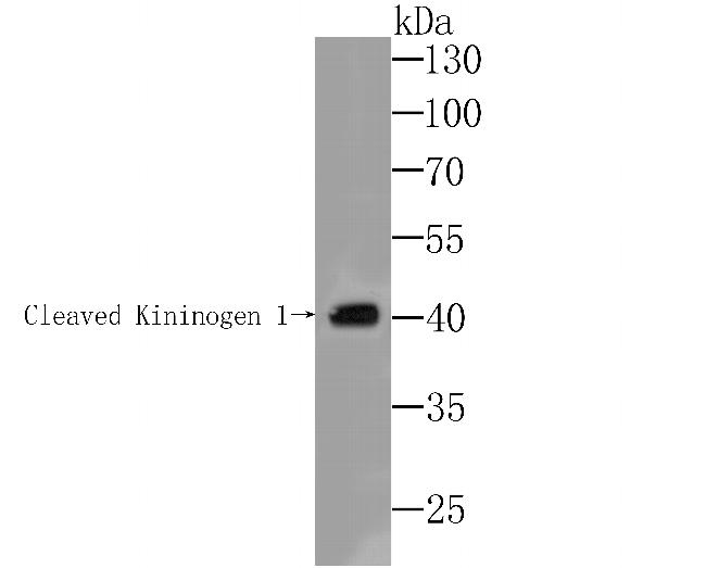 Kininogen 1 Antibody in Western Blot (WB)