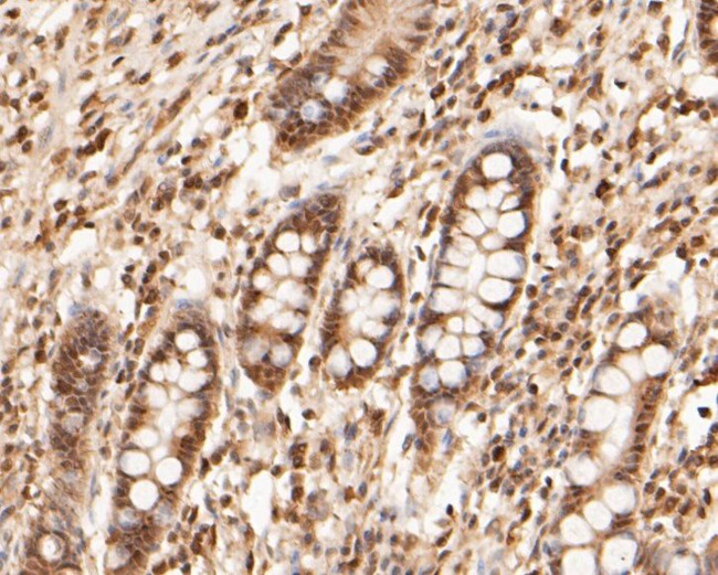 WAPL Antibody in Immunohistochemistry (Paraffin) (IHC (P))