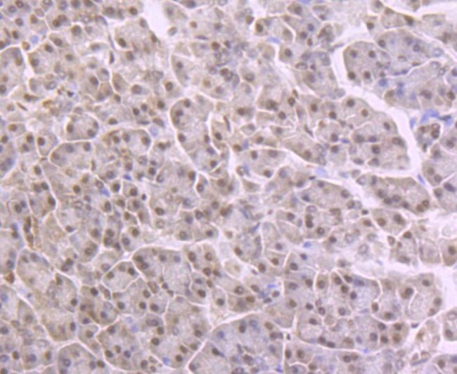 NFIB Antibody in Immunohistochemistry (Paraffin) (IHC (P))