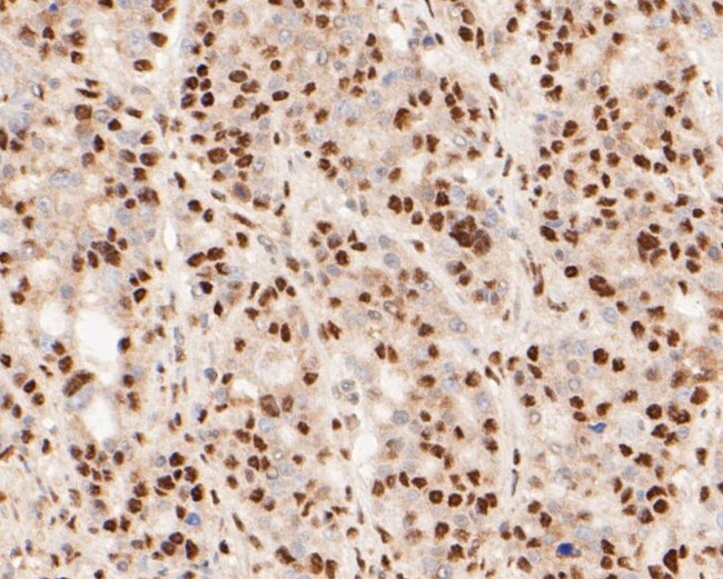 MTA2 Antibody in Immunohistochemistry (Paraffin) (IHC (P))