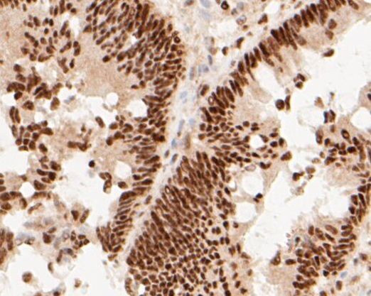 MTA2 Antibody in Immunohistochemistry (Paraffin) (IHC (P))