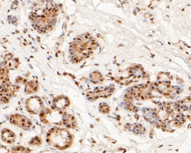 MTA2 Antibody in Immunohistochemistry (Paraffin) (IHC (P))