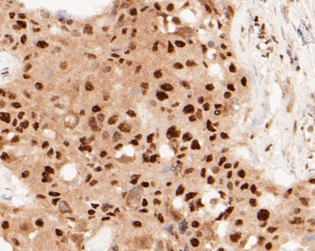 MTA2 Antibody in Immunohistochemistry (Paraffin) (IHC (P))