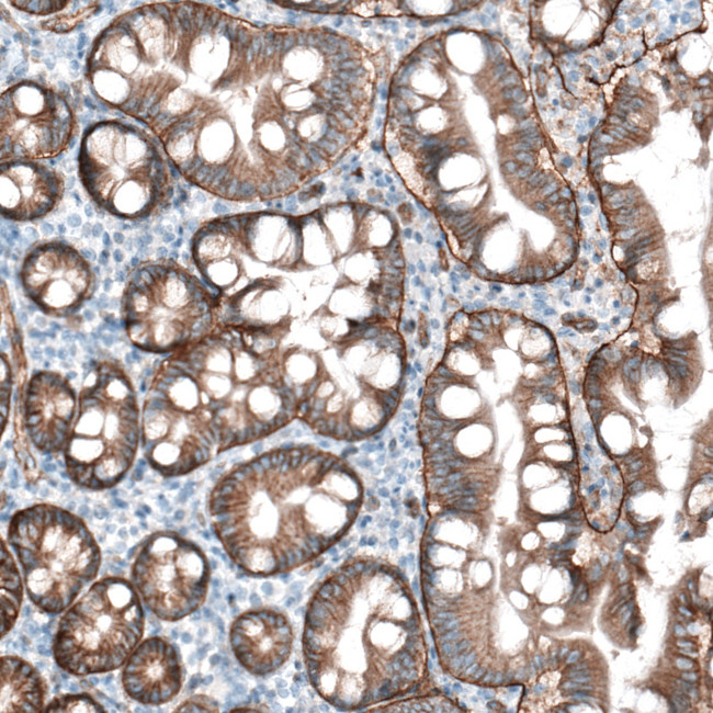 CD104 Antibody in Immunohistochemistry (Paraffin) (IHC (P))