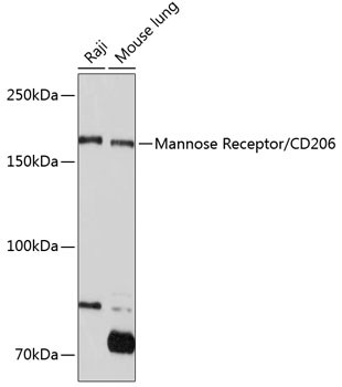 CD206 Antibody in Western Blot (WB)