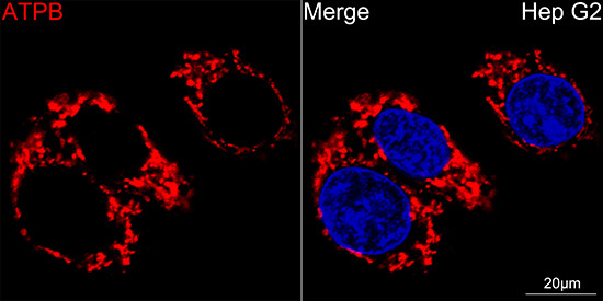 ATP Synthase beta Antibody in Immunocytochemistry (ICC/IF)