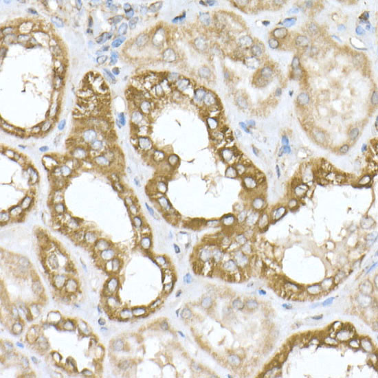 ATP Synthase beta Antibody in Immunohistochemistry (Paraffin) (IHC (P))