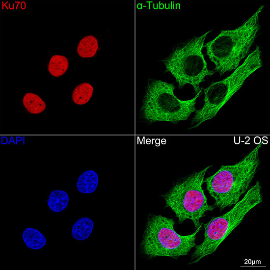 Ku70 Antibody in Immunocytochemistry (ICC/IF)