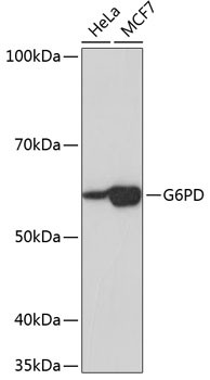 G6PD Antibody in Western Blot (WB)