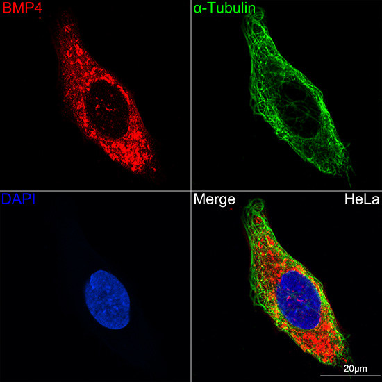 BMP4 Antibody in Immunocytochemistry (ICC/IF)