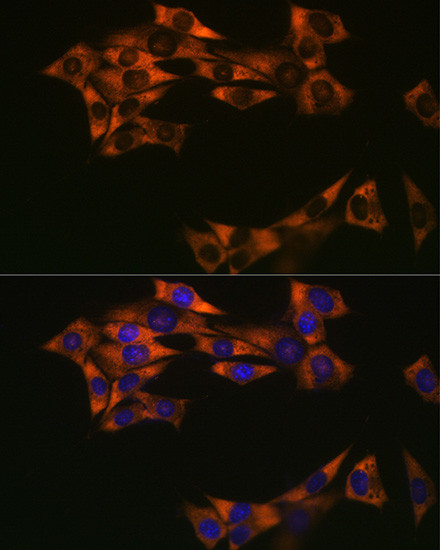 eIF4A1 Antibody in Immunocytochemistry (ICC/IF)