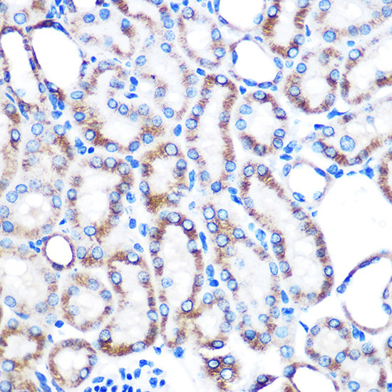 LUM Antibody in Immunohistochemistry (Paraffin) (IHC (P))