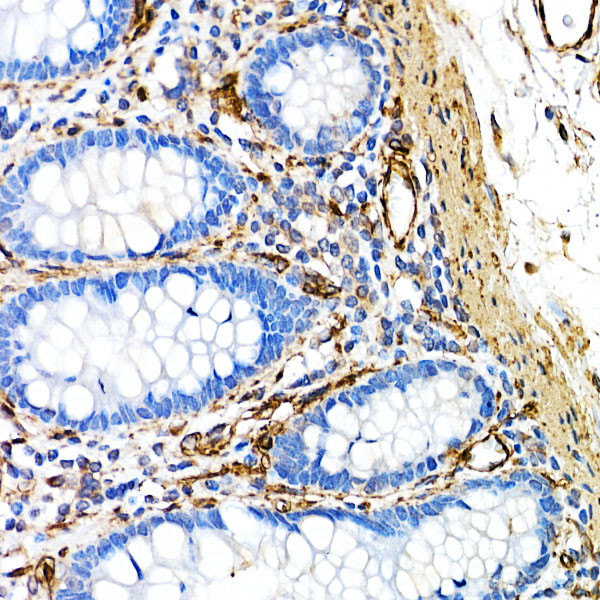 Caveolin 1 Antibody in Immunohistochemistry (Paraffin) (IHC (P))