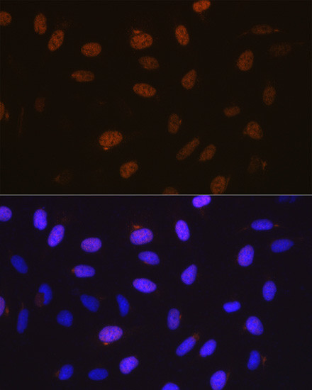 Cyclin A2 Antibody in Immunocytochemistry (ICC/IF)