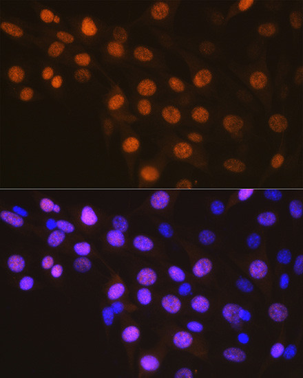 Cyclin A2 Antibody in Immunocytochemistry (ICC/IF)