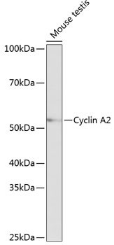 Cyclin A2 Antibody in Western Blot (WB)