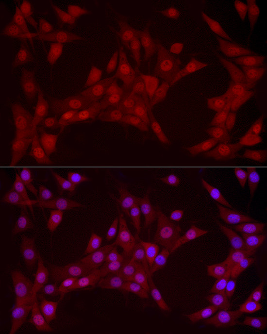 YAP1 Antibody in Immunocytochemistry (ICC/IF)