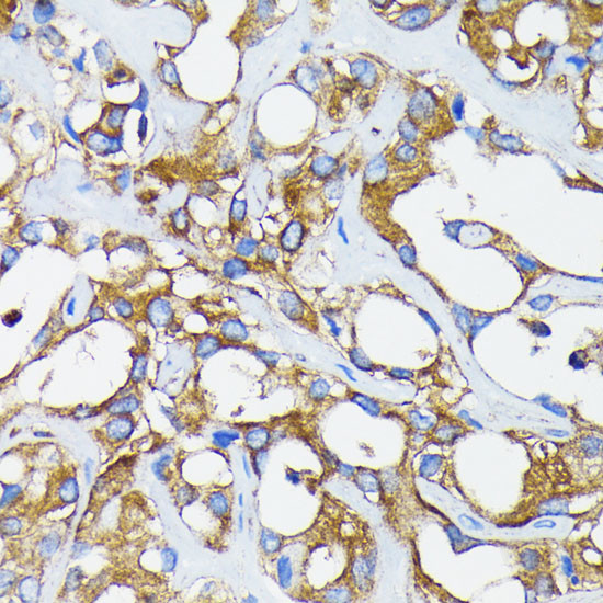 RARA Antibody in Immunohistochemistry (Paraffin) (IHC (P))