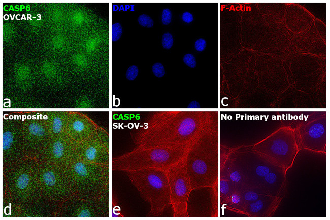 Caspase 6 Antibody in Immunocytochemistry (ICC/IF)