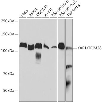 TRIM28 Antibody in Western Blot (WB)