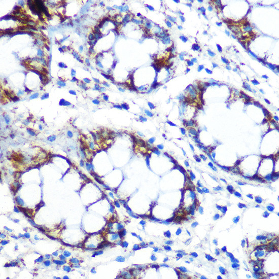 PRDX3 Antibody in Immunohistochemistry (Paraffin) (IHC (P))