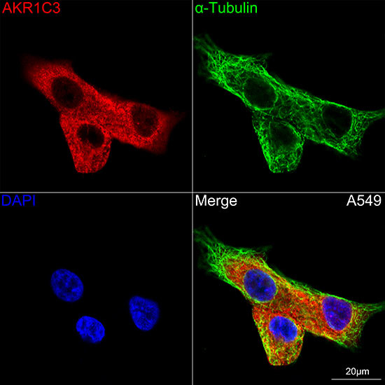 AKR1C3 Antibody in Immunocytochemistry (ICC/IF)