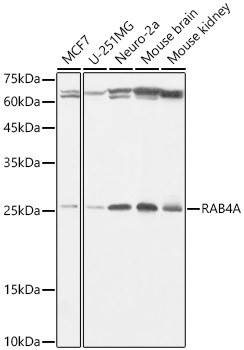 Rab4 Antibody in Western Blot (WB)