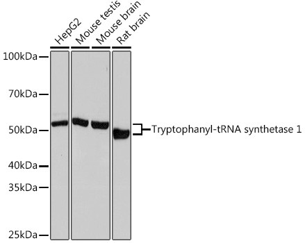 WARS Antibody in Western Blot (WB)