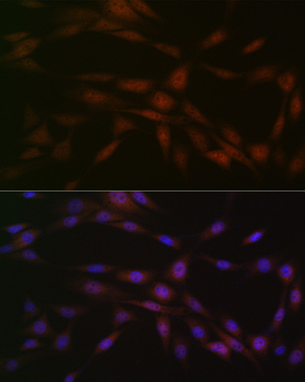 CK2 beta Antibody in Immunocytochemistry (ICC/IF)