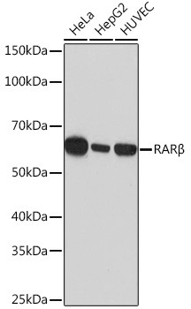 RARB Antibody in Western Blot (WB)