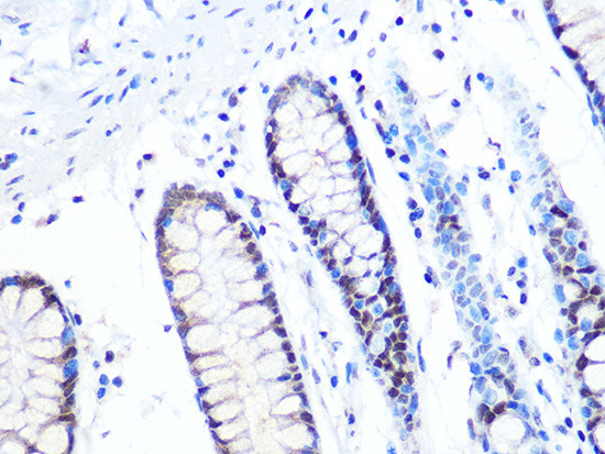 MTA2 Antibody in Immunohistochemistry (Paraffin) (IHC (P))