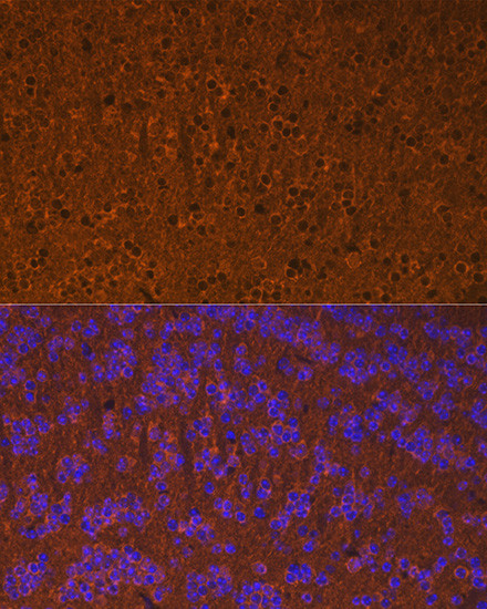 Calmodulin Antibody in Immunohistochemistry (Paraffin) (IHC (P))