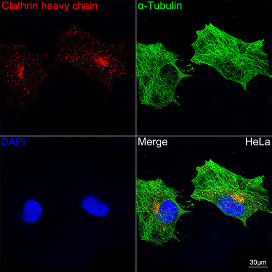 Clathrin Heavy Chain Antibody in Immunocytochemistry (ICC/IF)
