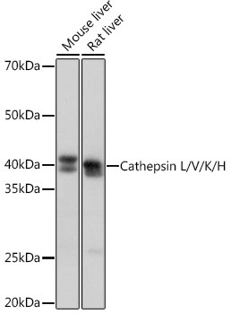 Cathepsin H/K/L/V Antibody in Western Blot (WB)