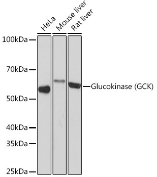 GCK Antibody in Western Blot (WB)