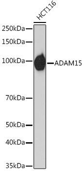 ADAM15 Antibody in Western Blot (WB)