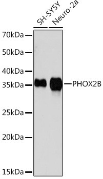 PHOX2B Antibody in Western Blot (WB)