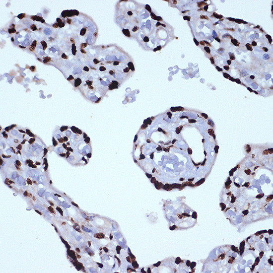 ILF3 Antibody in Immunohistochemistry (Paraffin) (IHC (P))