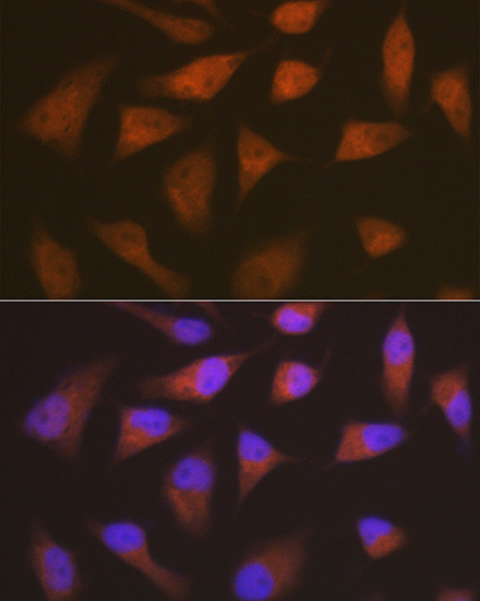 CDKN2C Antibody in Immunocytochemistry (ICC/IF)