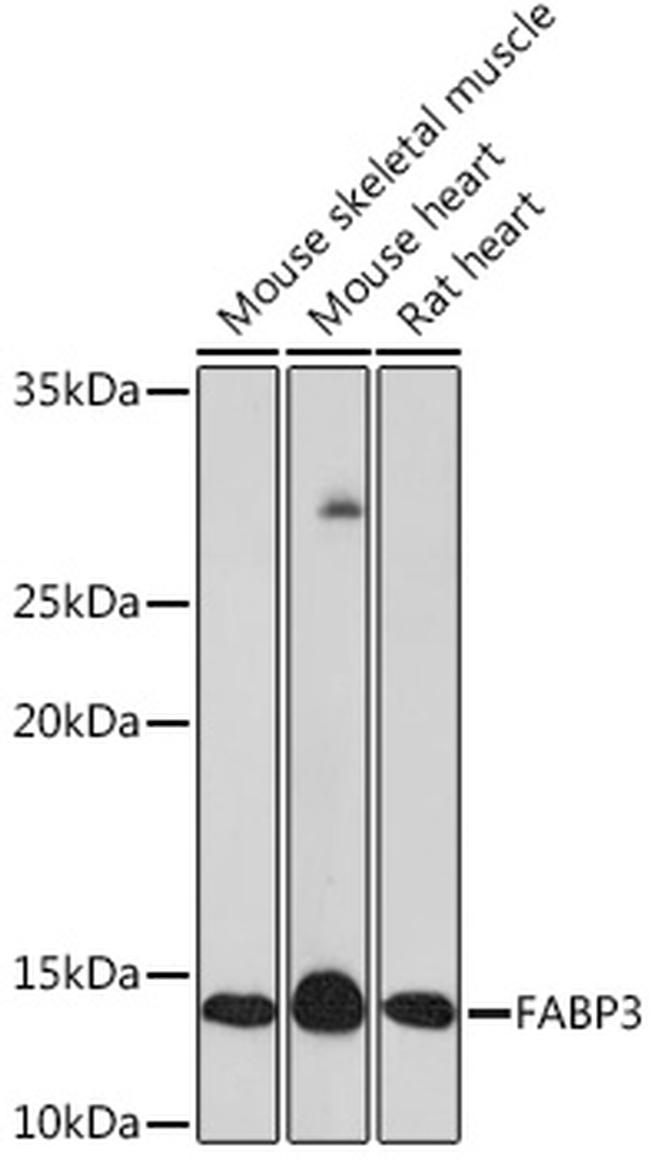 FABP3 Recombinant Monoclonal Antibody (ARC1302) (MA5-35719)