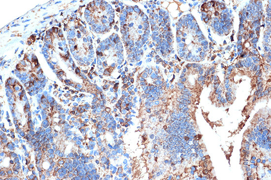 FABP2 Antibody in Immunohistochemistry (Paraffin) (IHC (P))