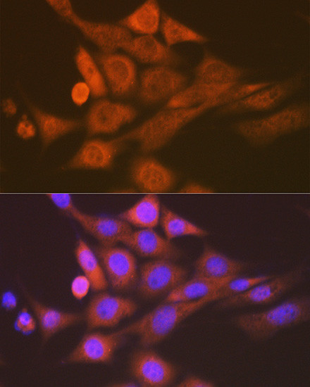 SKP1 Antibody in Immunocytochemistry (ICC/IF)