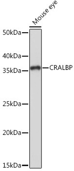 CRALBP Antibody in Western Blot (WB)