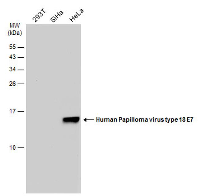 HPV Type 18 E7 Antibody in Western Blot (WB)