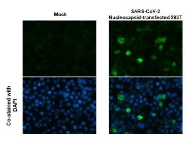 SARS-CoV/SARS-CoV-2 Nucleocapsid Antibody in Immunocytochemistry (ICC/IF)