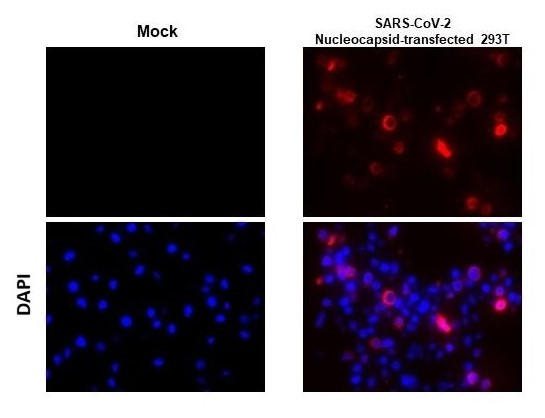 SARS-CoV/SARS-CoV-2 Nucleocapsid Antibody in Immunohistochemistry (Paraffin) (IHC (P))