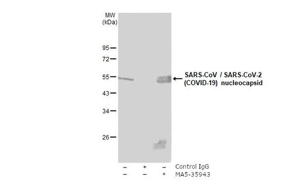 SARS-CoV/SARS-CoV-2 Nucleocapsid Antibody in Immunoprecipitation (IP)